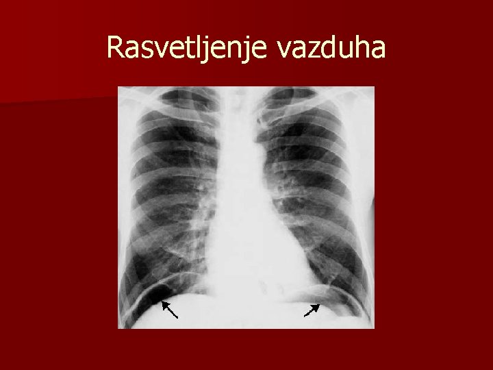 Rasvetljenje vazduha 