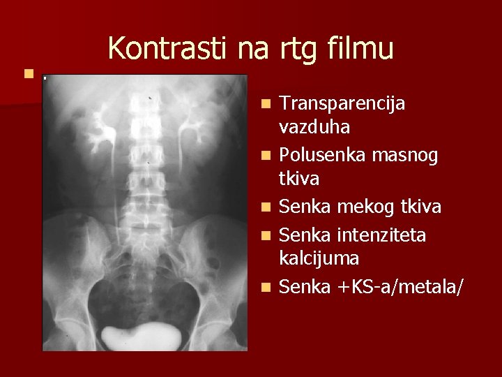n . Kontrasti na rtg filmu n n n Transparencija vazduha Polusenka masnog tkiva
