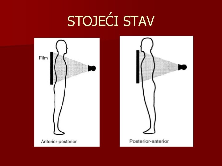 STOJEĆI STAV 