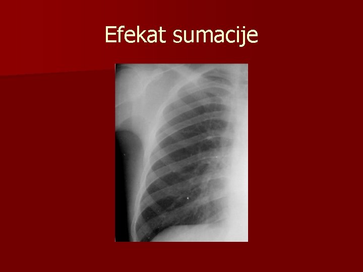 Efekat sumacije 