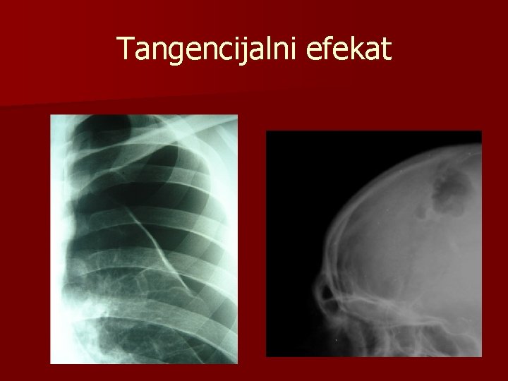Tangencijalni efekat 