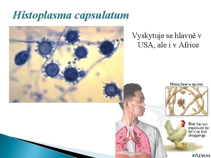 Histoplasma capsulatum Vyskytuje se hlavně v USA, ale i v Africe 