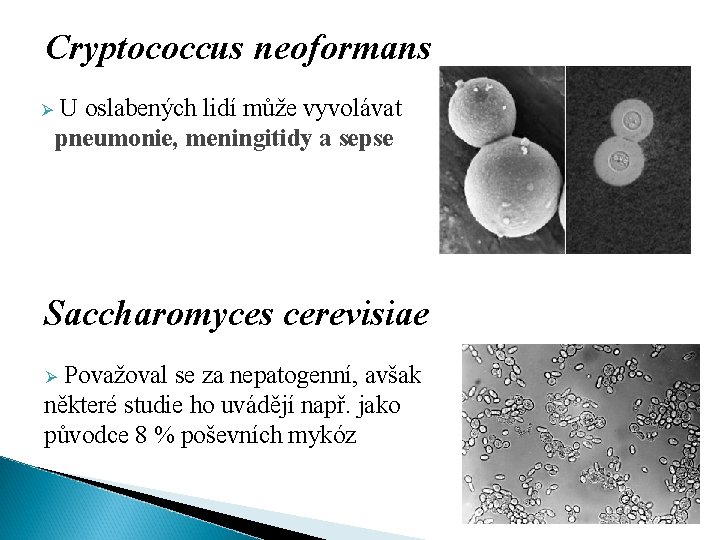 Cryptococcus neoformans Ø U oslabených lidí může vyvolávat pneumonie, meningitidy a sepse Saccharomyces cerevisiae