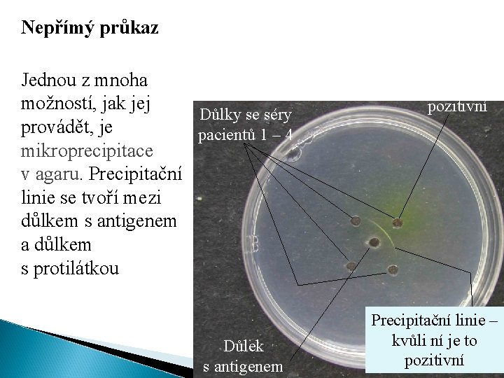 Nepřímý průkaz Jednou z mnoha možností, jak jej Důlky se séry provádět, je pacientů