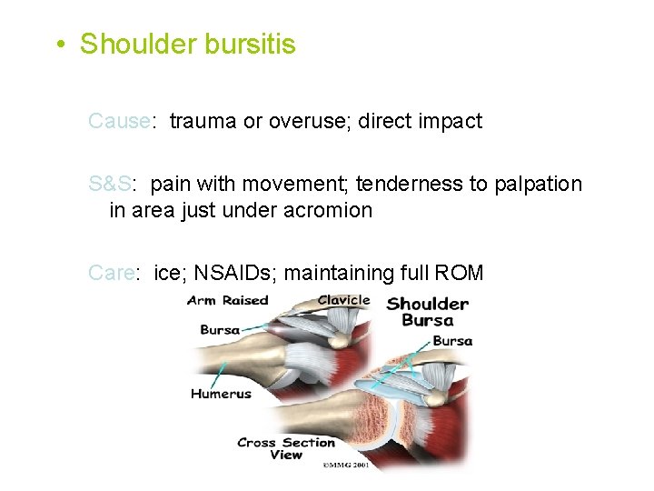  • Shoulder bursitis Cause: trauma or overuse; direct impact S&S: pain with movement;