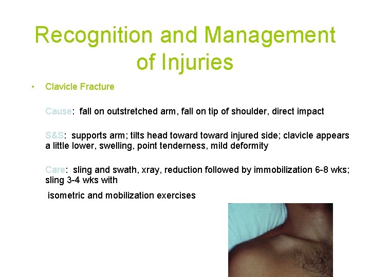 Recognition and Management of Injuries • Clavicle Fracture Cause: fall on outstretched arm, fall