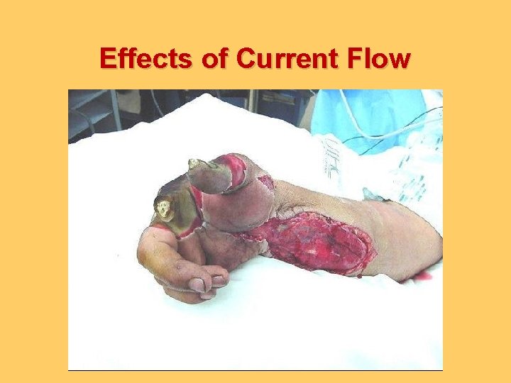 Effects of Current Flow 