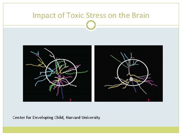 Impact of Toxic Stress on the Brain Center for Developing Child, Harvard University 