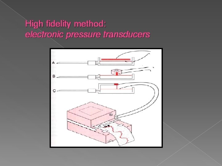 High fidelity method: electronic pressure transducers 