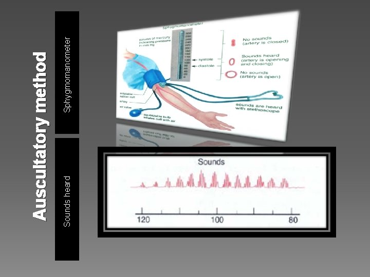 Sounds heard Sphygmomanometer Auscultatory method 