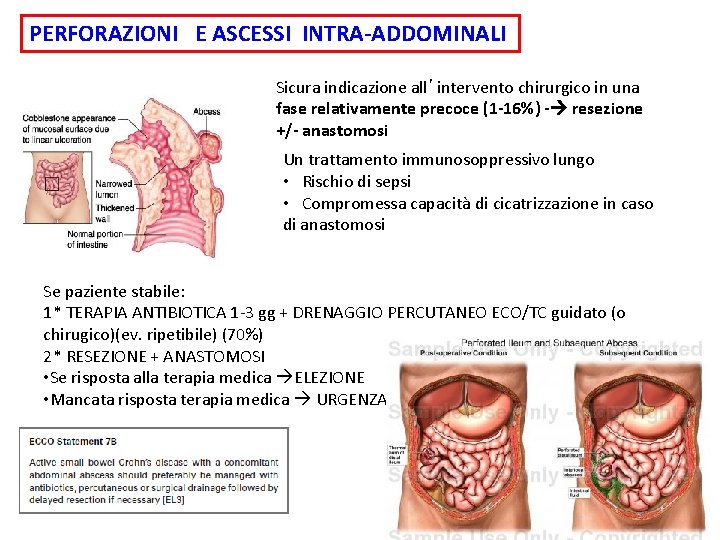 PERFORAZIONI E ASCESSI INTRA-ADDOMINALI Sicura indicazione all’intervento chirurgico in una fase relativamente precoce (1