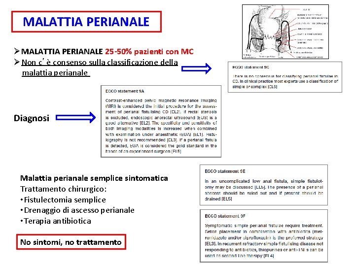 MALATTIA PERIANALE ØMALATTIA PERIANALE 25 -50% pazienti con MC ØNon c’è consenso sulla classificazione