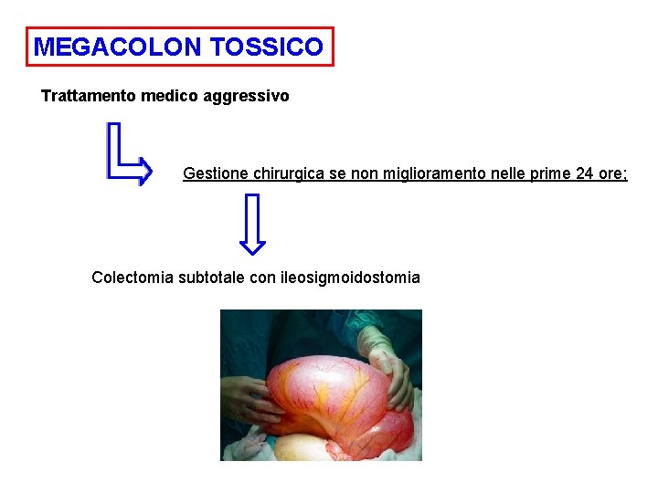 MEGACOLON TOSSICO Trattamento medico aggressivo Gestione chirurgica se non miglioramento nelle prime 24 ore;