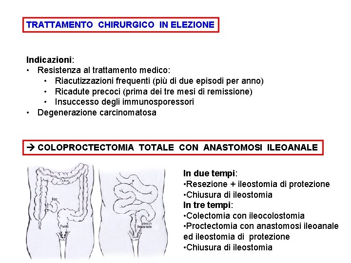 TRATTAMENTO CHIRURGICO IN ELEZIONE Indicazioni: • Resistenza al trattamento medico: • Riacutizzazioni frequenti (più