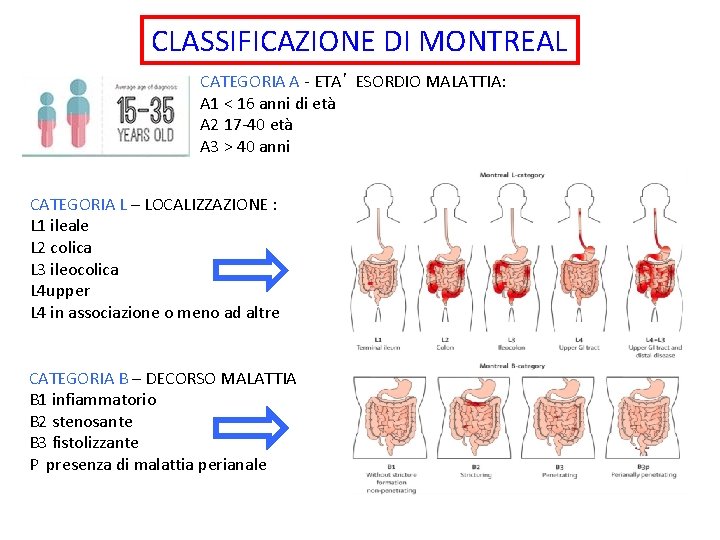 CLASSIFICAZIONE DI MONTREAL CATEGORIA A - ETA’ ESORDIO MALATTIA: A 1 < 16 anni