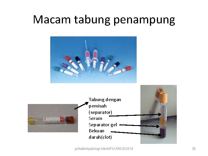 Macam tabung penampung Tabung dengan pemisah (separator) Serum Separator gel Bekuan darah(clot) prihatini/patologi klinik/FKUWKS/2014