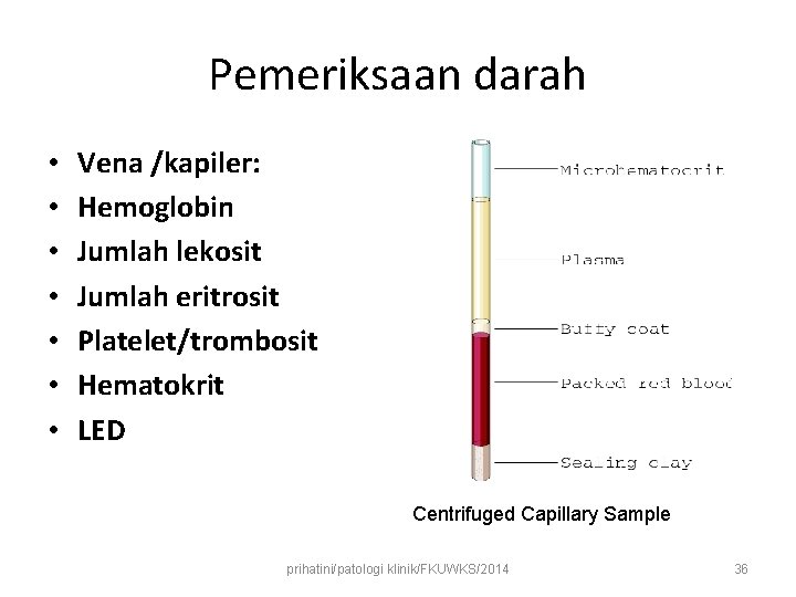 Pemeriksaan darah • • Vena /kapiler: Hemoglobin Jumlah lekosit Jumlah eritrosit Platelet/trombosit Hematokrit LED