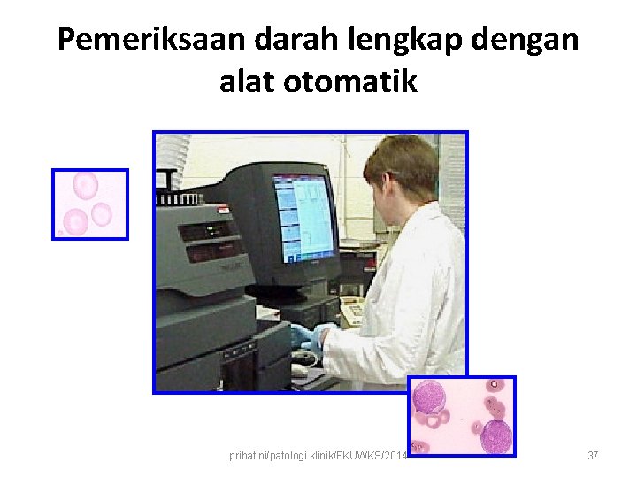 Pemeriksaan darah lengkap dengan alat otomatik prihatini/patologi klinik/FKUWKS/2014 37 