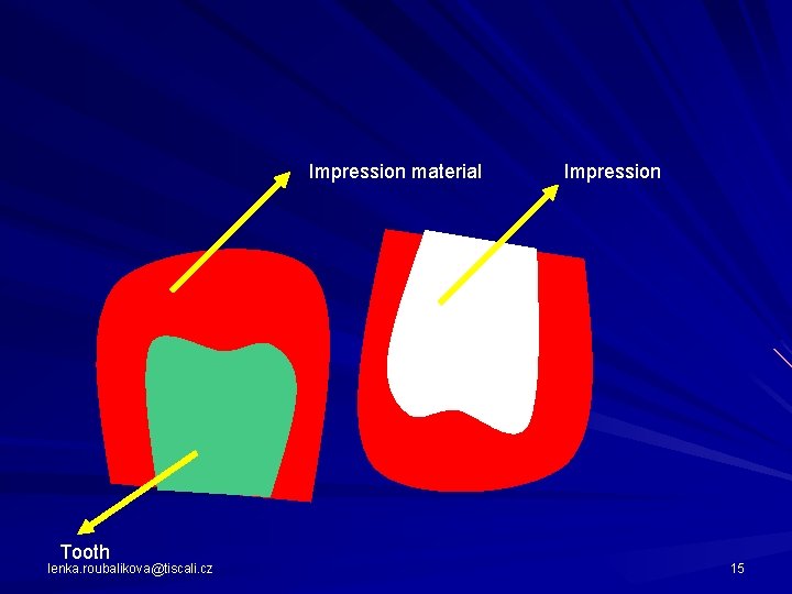 Impression material Tooth lenka. roubalikova@tiscali. cz Impression 15 