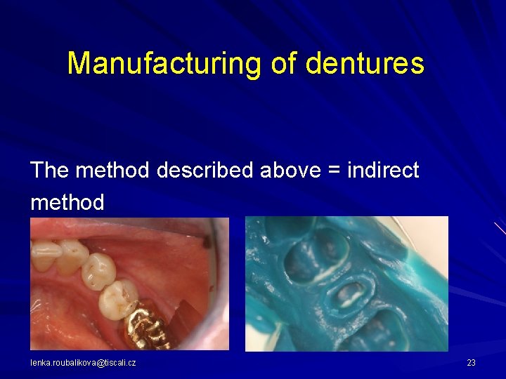 Manufacturing of dentures The method described above = indirect method lenka. roubalikova@tiscali. cz 23