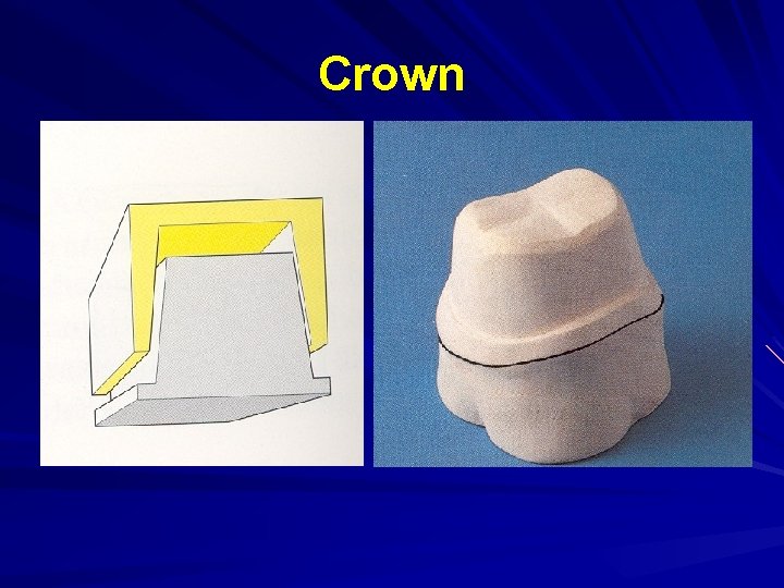 Crown Korunka 