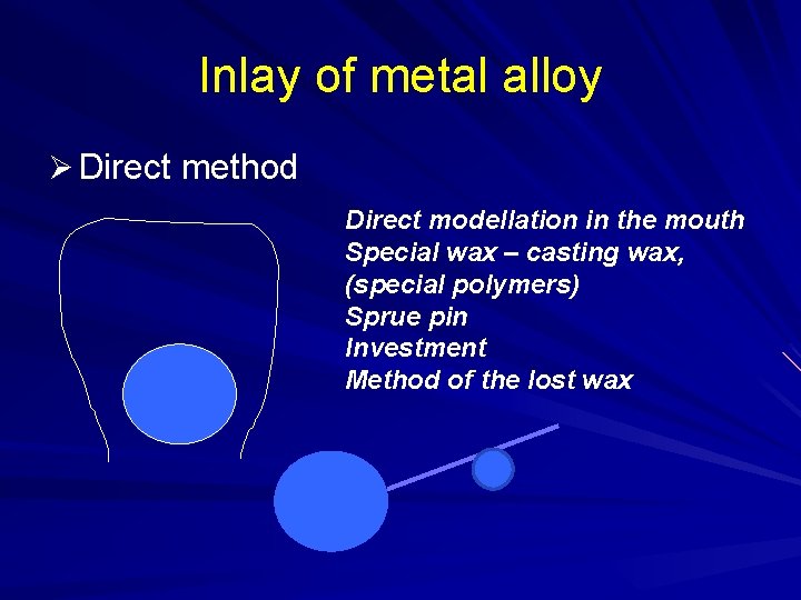 Inlay of metal alloy Ø Direct method Direct modellation in the mouth Special wax
