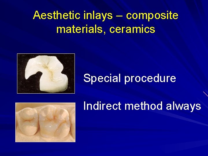 Aesthetic inlays – composite materials, ceramics Special procedure Indirect method always 