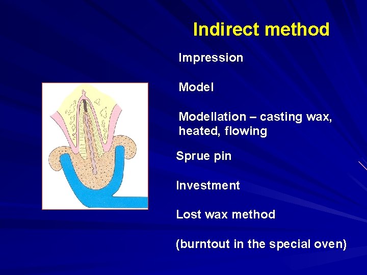 Indirect method Impression Modellation – casting wax, heated, flowing Sprue pin Investment Lost wax