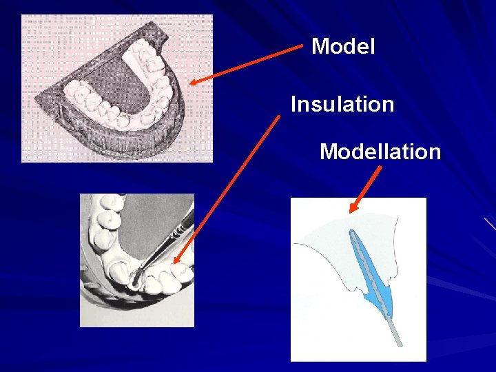 Model Insulation Modellation 