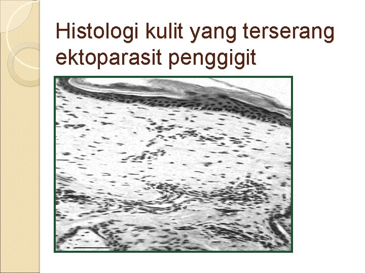 Histologi kulit yang terserang ektoparasit penggigit 