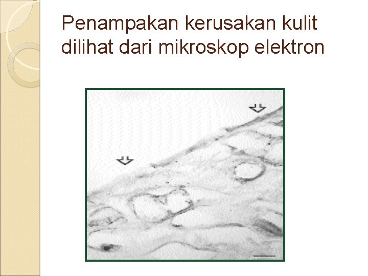 Penampakan kerusakan kulit dilihat dari mikroskop elektron 