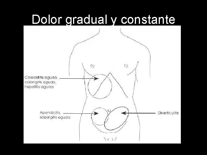 Dolor gradual y constante 