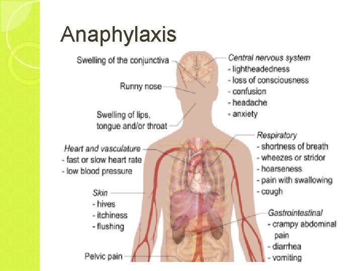 Anaphylaxis 