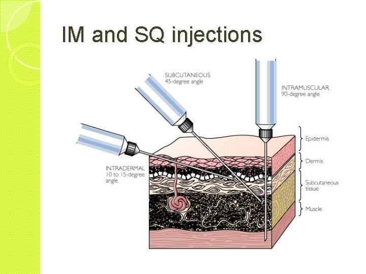 IM and SQ injections 