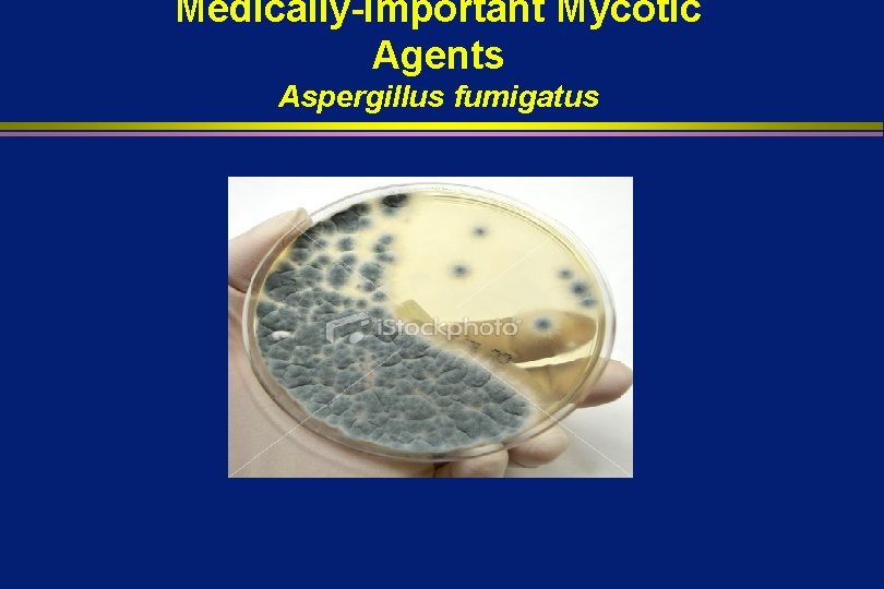 Medically-Important Mycotic Agents Aspergillus fumigatus 