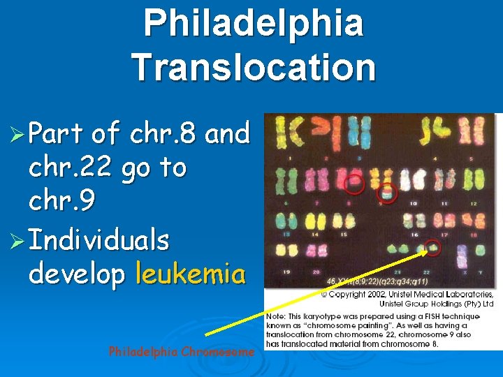 Philadelphia Translocation Ø Part of chr. 8 and chr. 22 go to chr. 9