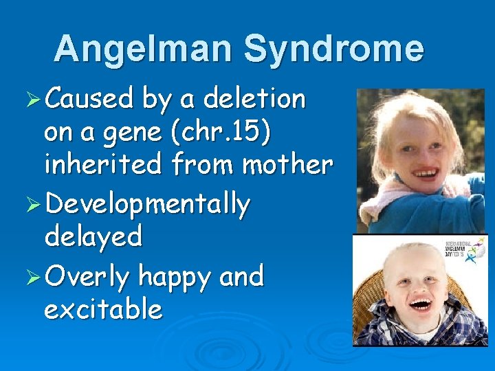 Angelman Syndrome Ø Caused by a deletion on a gene (chr. 15) inherited from