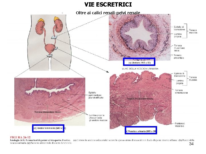 VIE ESCRETRICI Oltre ai calici renali-pelvi renale 34 