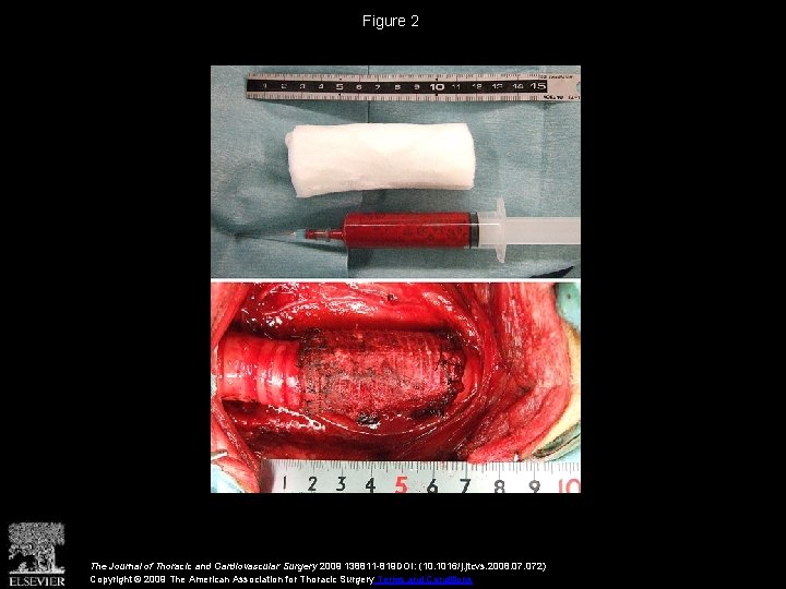 Figure 2 The Journal of Thoracic and Cardiovascular Surgery 2009 138811 -819 DOI: (10.