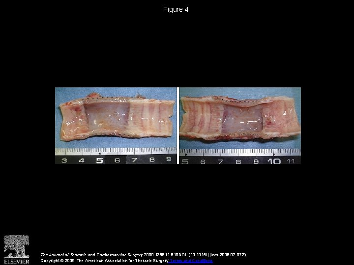 Figure 4 The Journal of Thoracic and Cardiovascular Surgery 2009 138811 -819 DOI: (10.