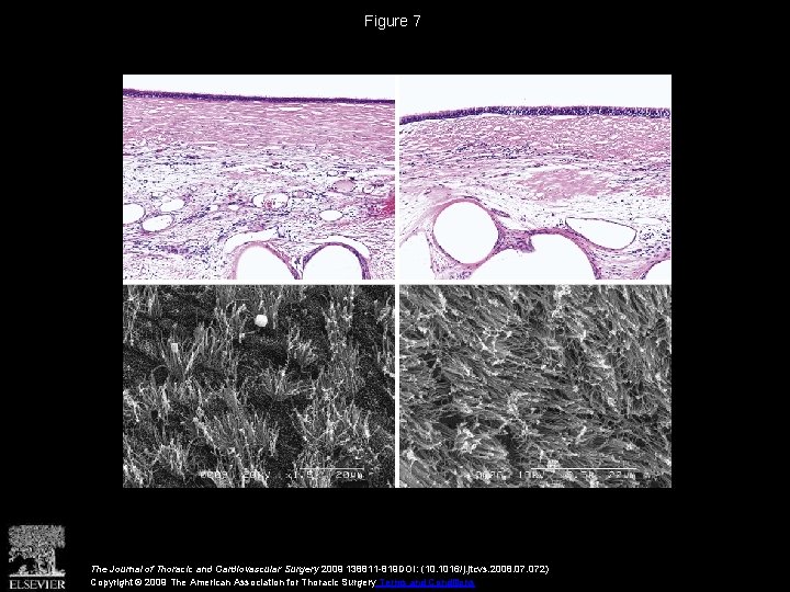 Figure 7 The Journal of Thoracic and Cardiovascular Surgery 2009 138811 -819 DOI: (10.