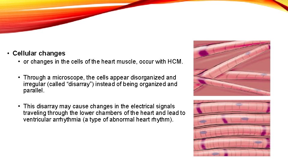  • Cellular changes • or changes in the cells of the heart muscle,
