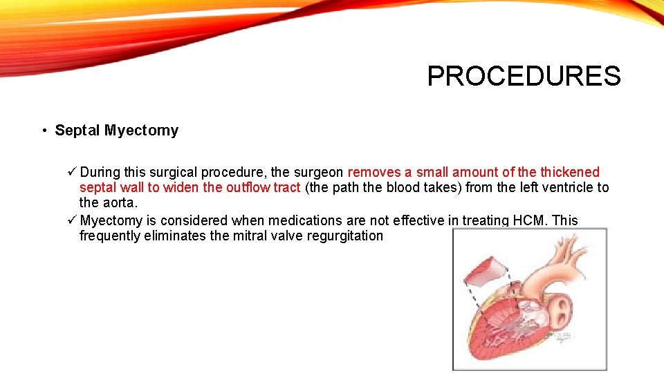 PROCEDURES • Septal Myectomy ü During this surgical procedure, the surgeon removes a small