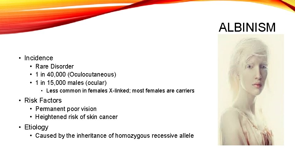 ALBINISM • Incidence • Rare Disorder • 1 in 40, 000 (Oculocutaneous) • 1