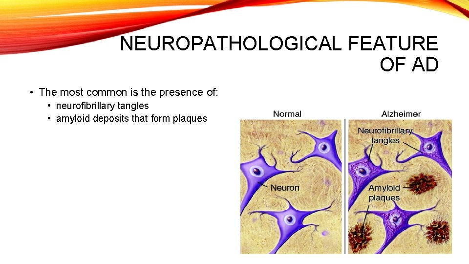 NEUROPATHOLOGICAL FEATURE OF AD • The most common is the presence of: • neurofibrillary