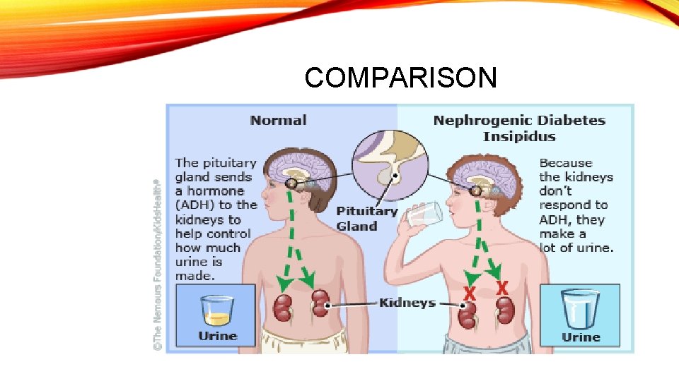 COMPARISON 