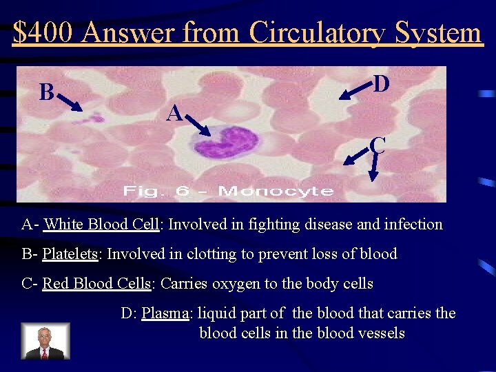 $400 Answer from Circulatory System B D A C A- White Blood Cell: Involved