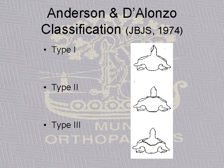 Anderson & D’Alonzo Classification (JBJS, 1974) • Type III 