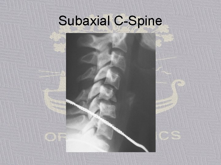 Subaxial C-Spine 