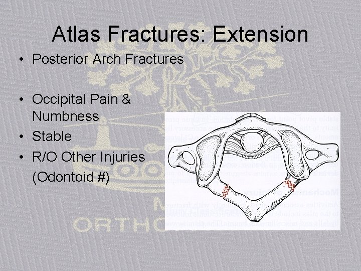 Atlas Fractures: Extension • Posterior Arch Fractures • Occipital Pain & Numbness • Stable